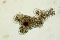 Common amoeba: description, reproduction, habitat Significance in nature and human life